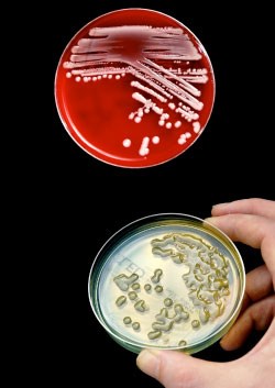bacteria3.jpg
